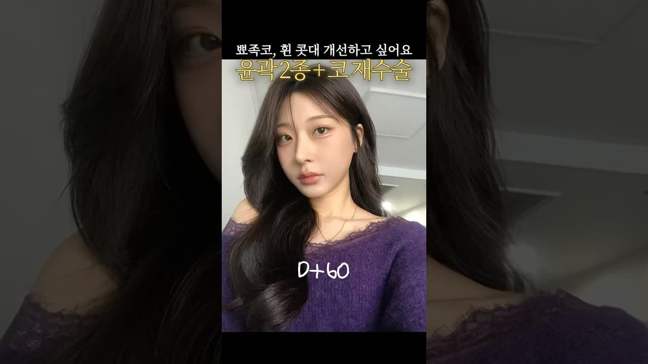 윤곽 2종 + 인중코 재수술💗