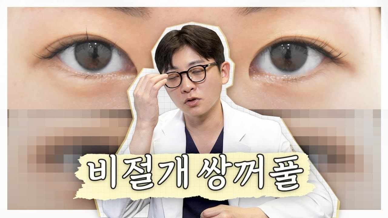 저 쌍꺼풀 수술 하고싶은데... 비절개로 해도 될까요?