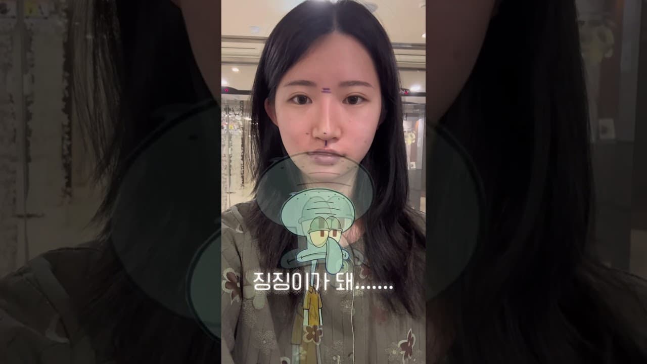코 수술했는데 시간이 갈수록 처지고,점점 복코처럼 퍼져 보인다면?👃인중코 재수술 ‼️