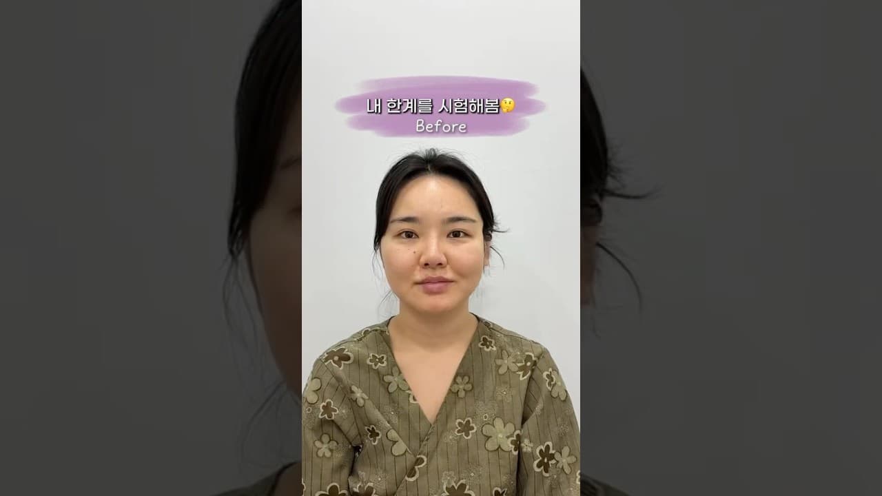 윤곽 3종+안면거상+이마축소 🌟